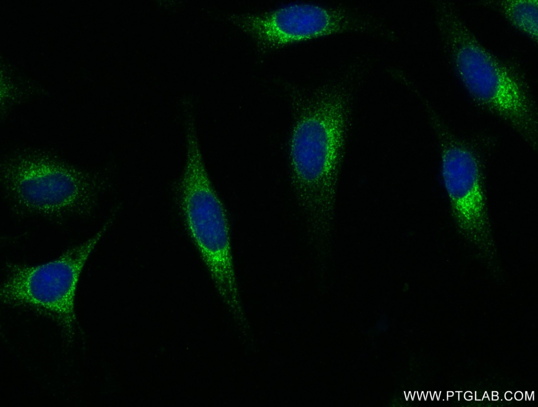 Immunofluorescence (IF) / fluorescent staining of HeLa cells using SEC24A Recombinant antibody (82908-1-RR)