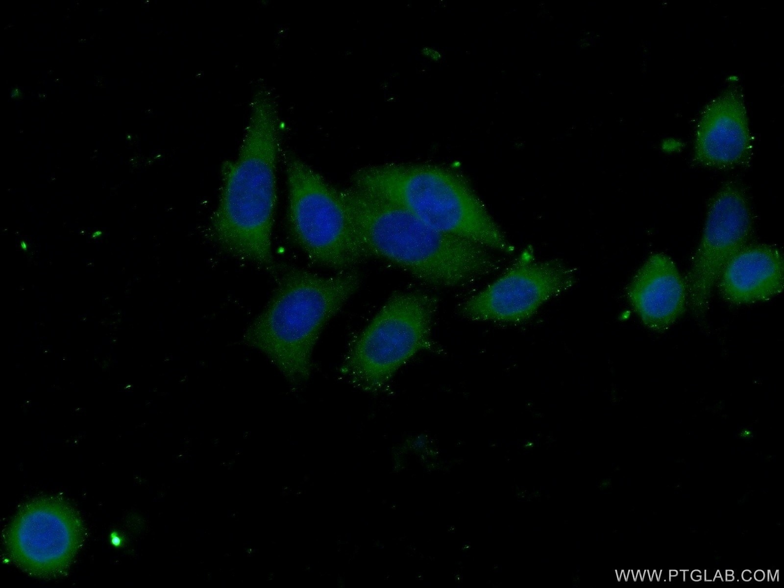Immunofluorescence (IF) / fluorescent staining of HeLa cells using SEC24C Polyclonal antibody (16073-1-AP)