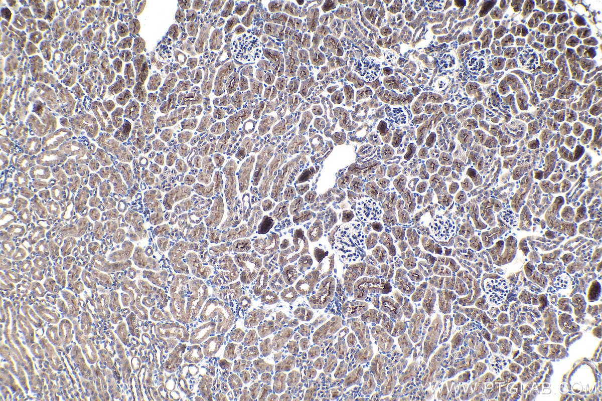 Immunohistochemistry (IHC) staining of mouse kidney tissue using SEC24C Polyclonal antibody (16073-1-AP)