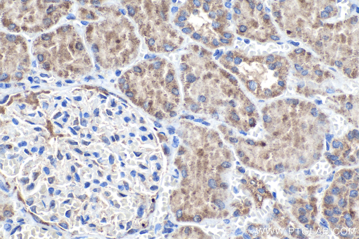Immunohistochemistry (IHC) staining of human kidney tissue using SEC24C Polyclonal antibody (16073-1-AP)