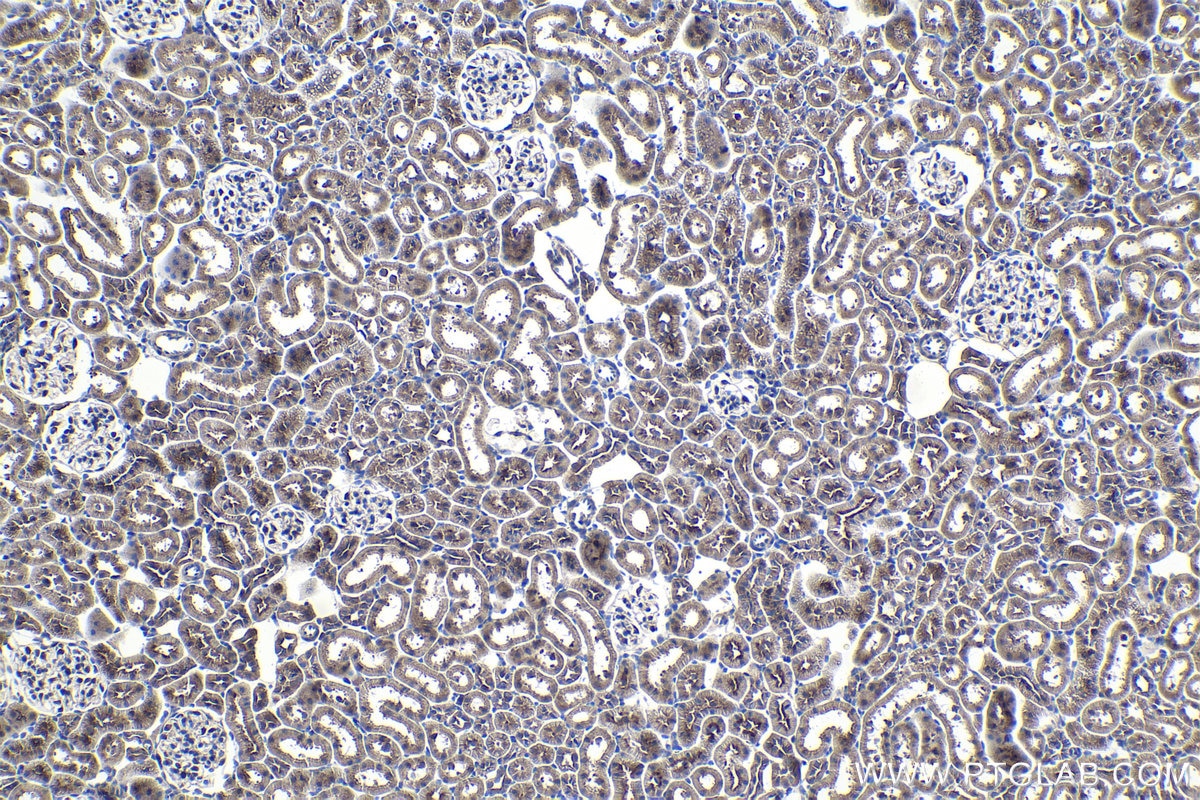 Immunohistochemistry (IHC) staining of rat kidney tissue using SEC24C Polyclonal antibody (16073-1-AP)