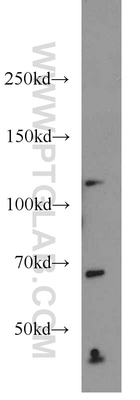 Western Blot (WB) analysis of HeLa cells using SEC24C Polyclonal antibody (16073-1-AP)