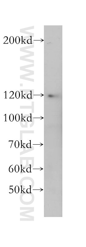 Western Blot (WB) analysis of HeLa cells using SEC24C Polyclonal antibody (16073-1-AP)