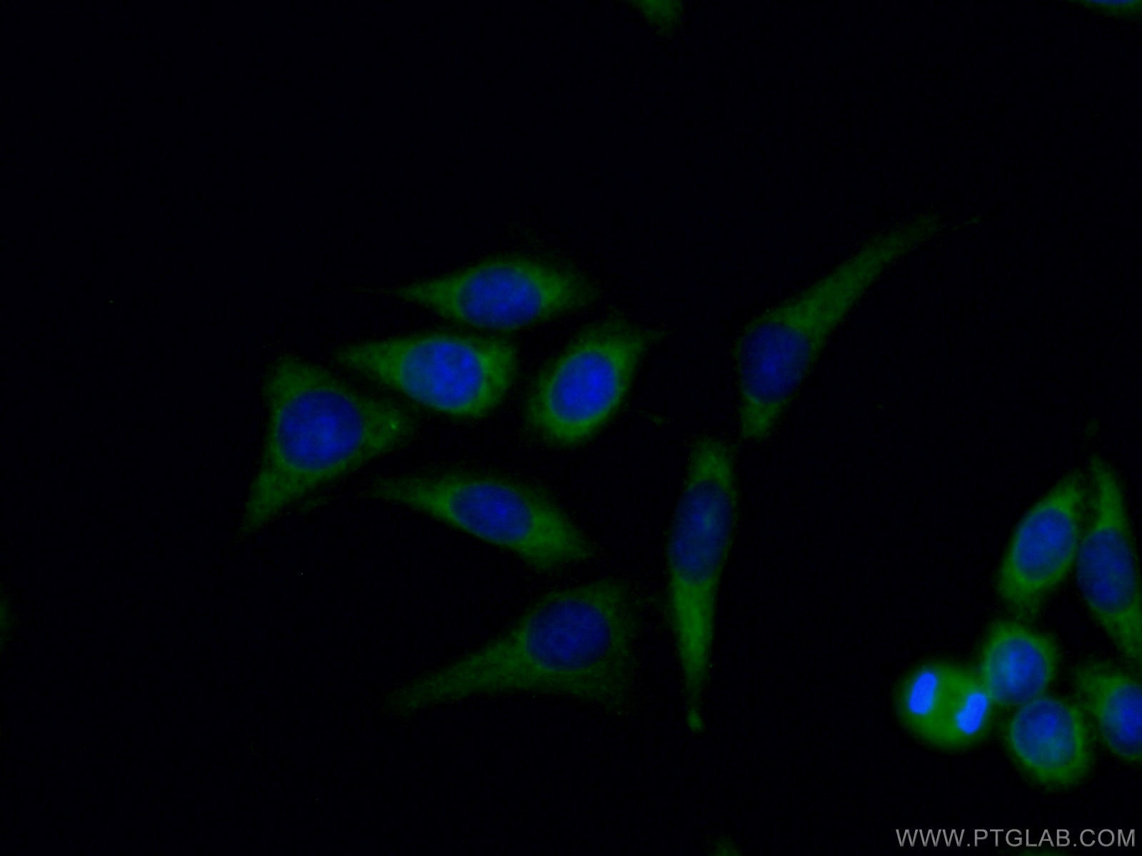 Immunofluorescence (IF) / fluorescent staining of HeLa cells using SEC24D Polyclonal antibody (13673-1-AP)