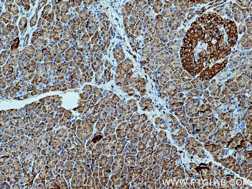 Immunohistochemistry (IHC) staining of human pancreas tissue using SEC24D Polyclonal antibody (13673-1-AP)