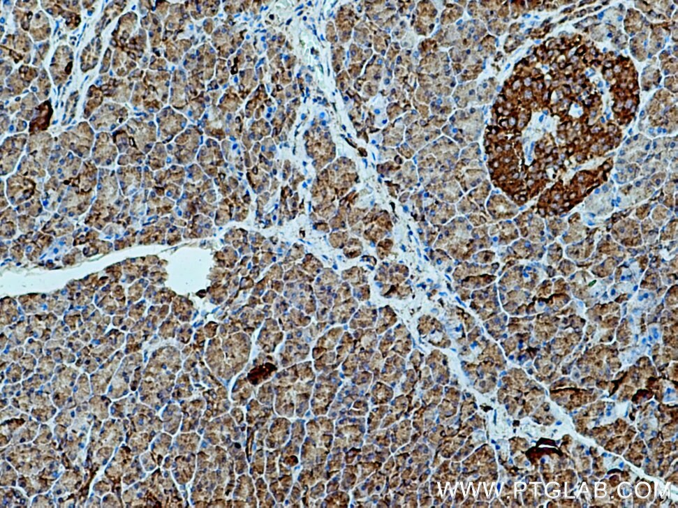 IHC staining of human pancreas using 13673-1-AP