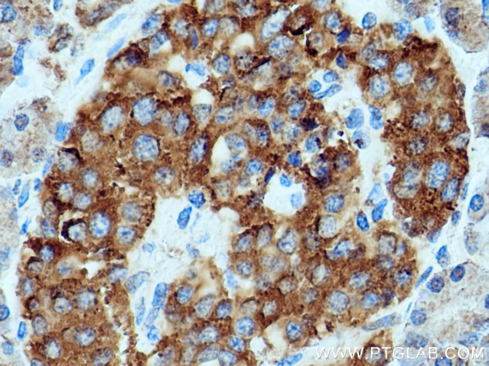 Immunohistochemistry (IHC) staining of human pancreas tissue using SEC24D Polyclonal antibody (13673-1-AP)