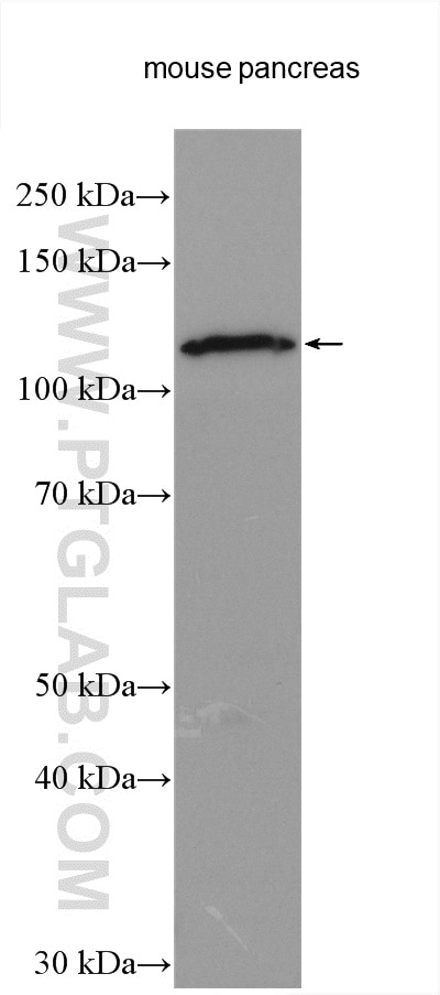 Western Blot (WB) analysis of various lysates using SEC24D Polyclonal antibody (13673-1-AP)