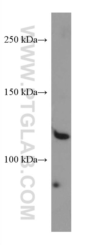 Western Blot (WB) analysis of HeLa cells using SEC24D Monoclonal antibody (67409-1-Ig)