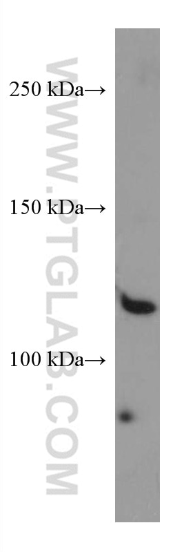 Western Blot (WB) analysis of HeLa cells using SEC24D Monoclonal antibody (67409-1-Ig)