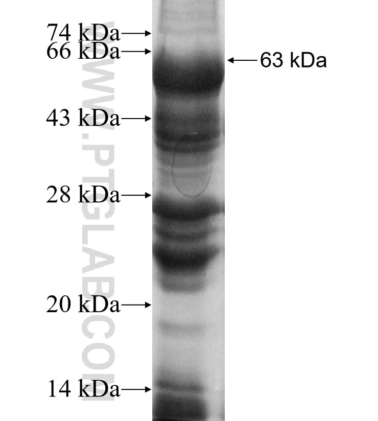 SEC24D fusion protein Ag4657 SDS-PAGE