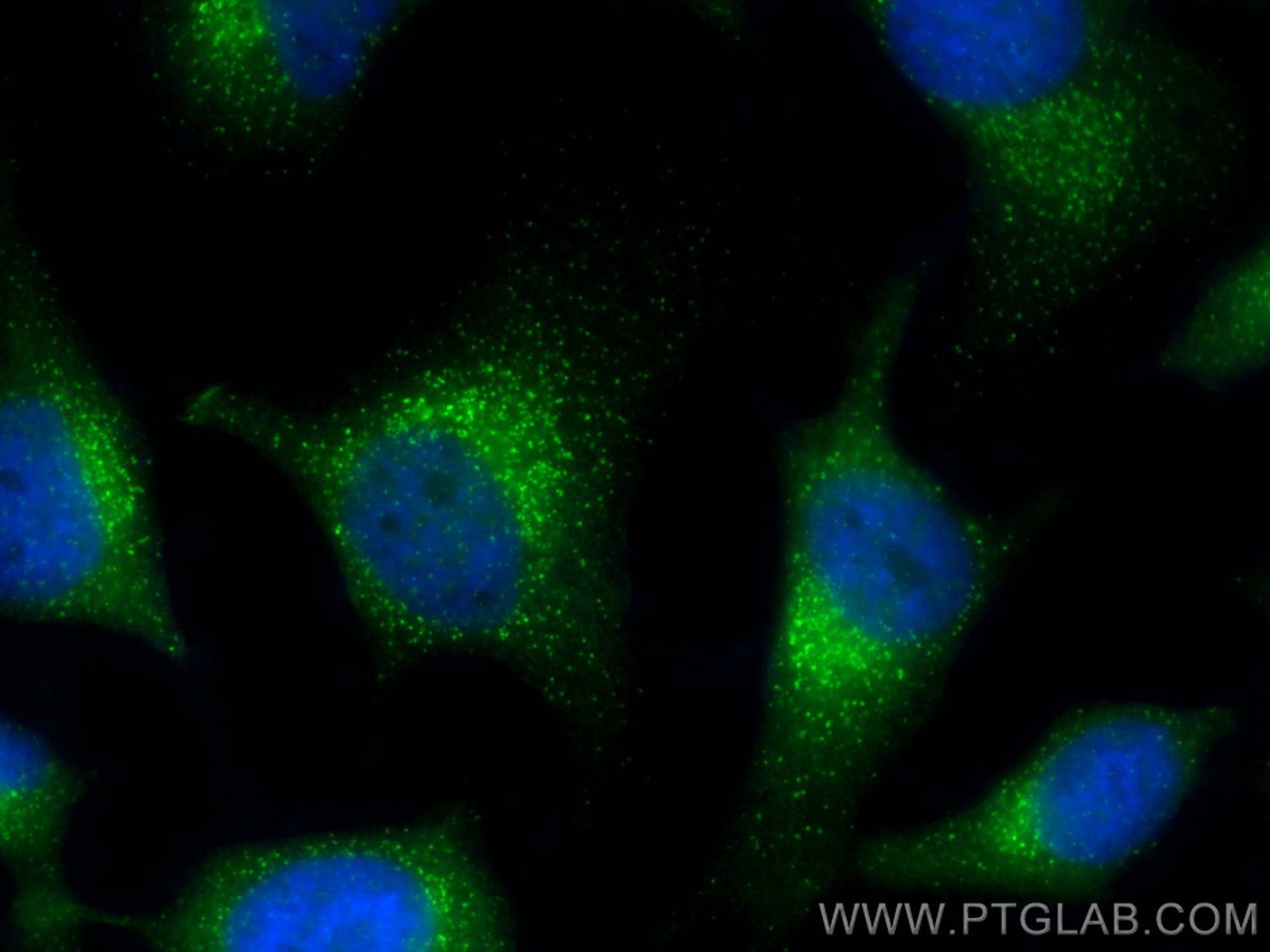 Immunofluorescence (IF) / fluorescent staining of HeLa cells using SEC31A Polyclonal antibody (17913-1-AP)