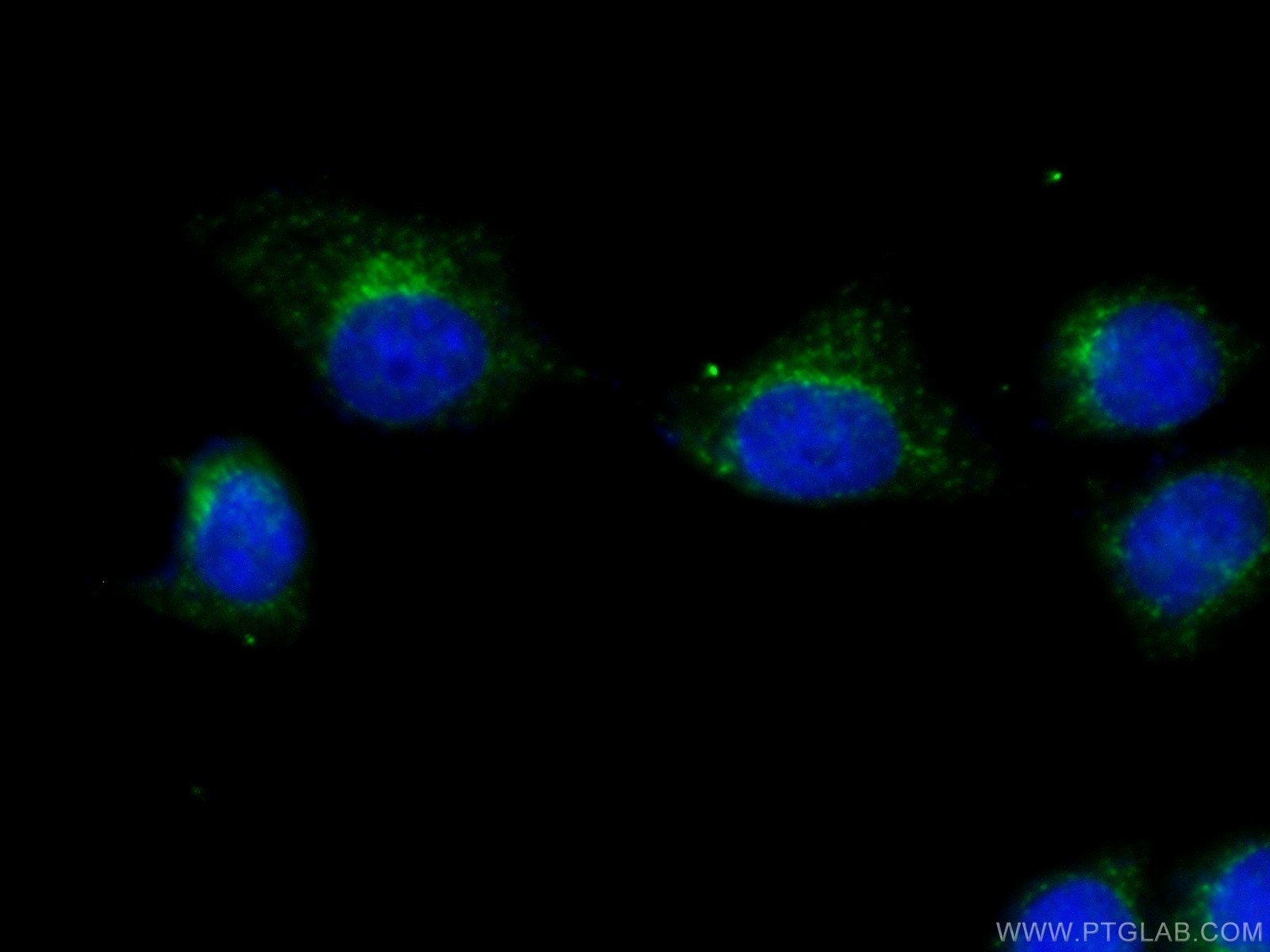 Immunofluorescence (IF) / fluorescent staining of HeLa cells using SEC31A Polyclonal antibody (17913-1-AP)