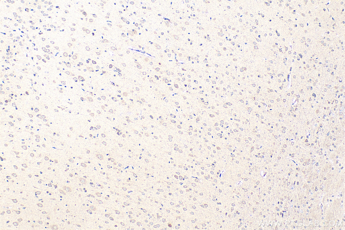 Immunohistochemistry (IHC) staining of rat brain tissue using SEC31A Polyclonal antibody (17913-1-AP)
