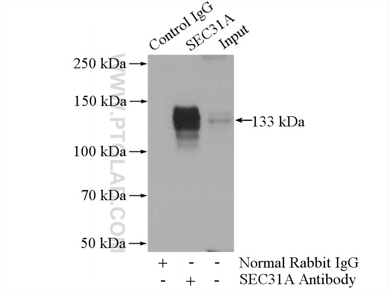 Immunoprecipitation (IP) experiment of HeLa cells using SEC31A Polyclonal antibody (17913-1-AP)