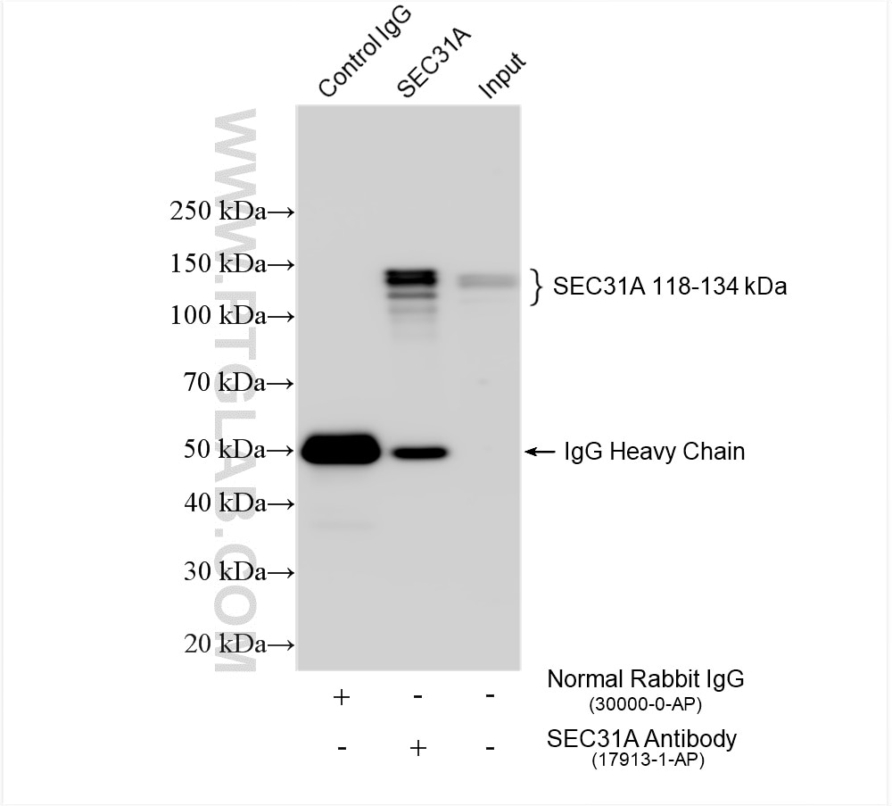 Immunoprecipitation (IP) experiment of HeLa cells using SEC31A Polyclonal antibody (17913-1-AP)