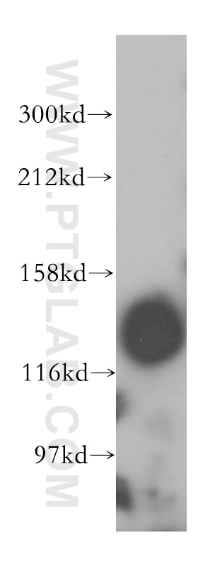 SEC31A Polyclonal antibody
