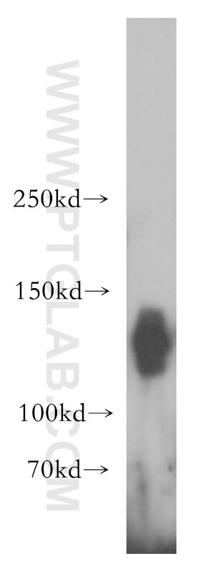 Western Blot (WB) analysis of Jurkat cells using SEC31A Polyclonal antibody (17913-1-AP)