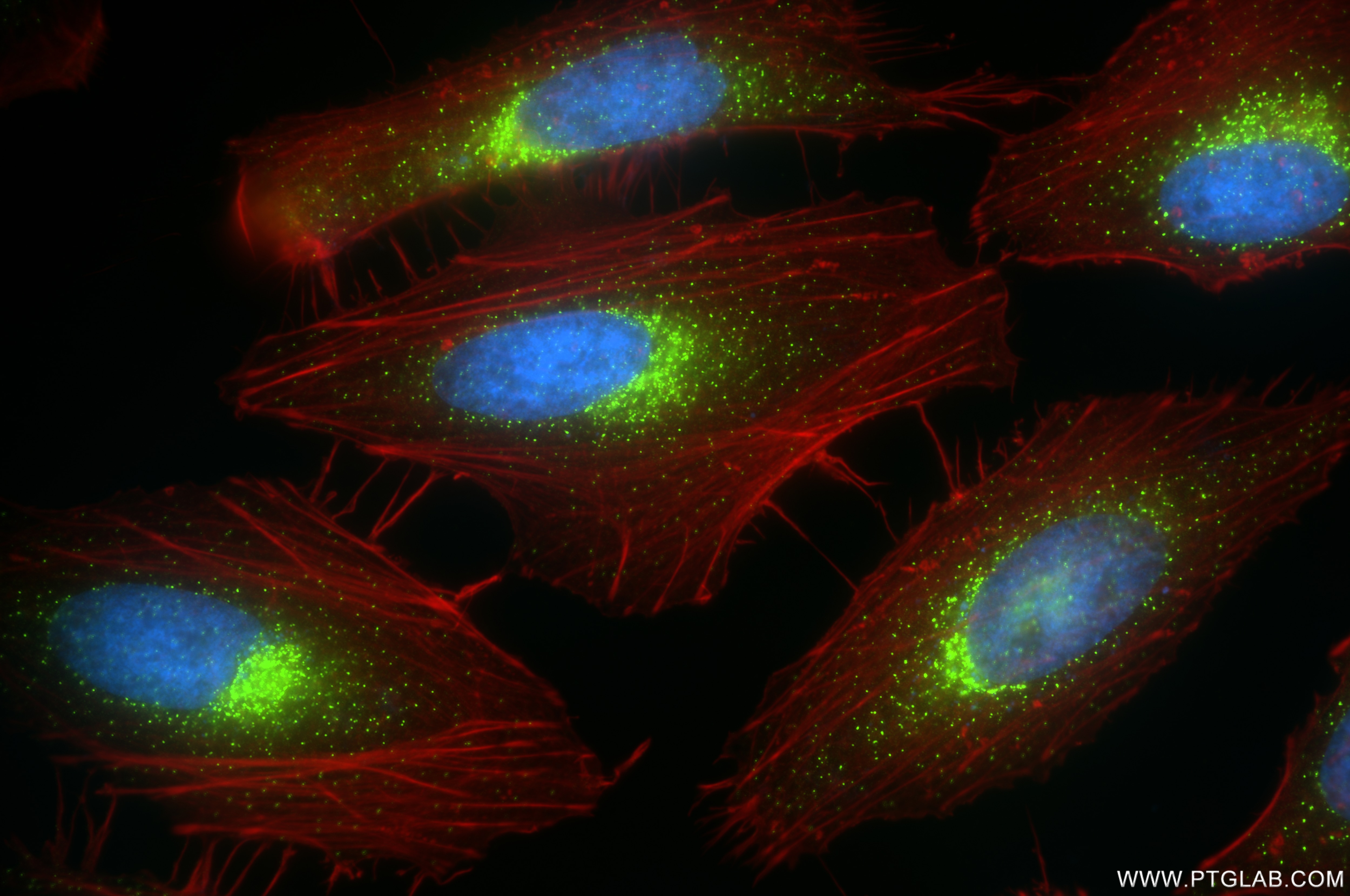 Immunofluorescence (IF) / fluorescent staining of HeLa cells using SEC31A Recombinant antibody (84942-4-RR)