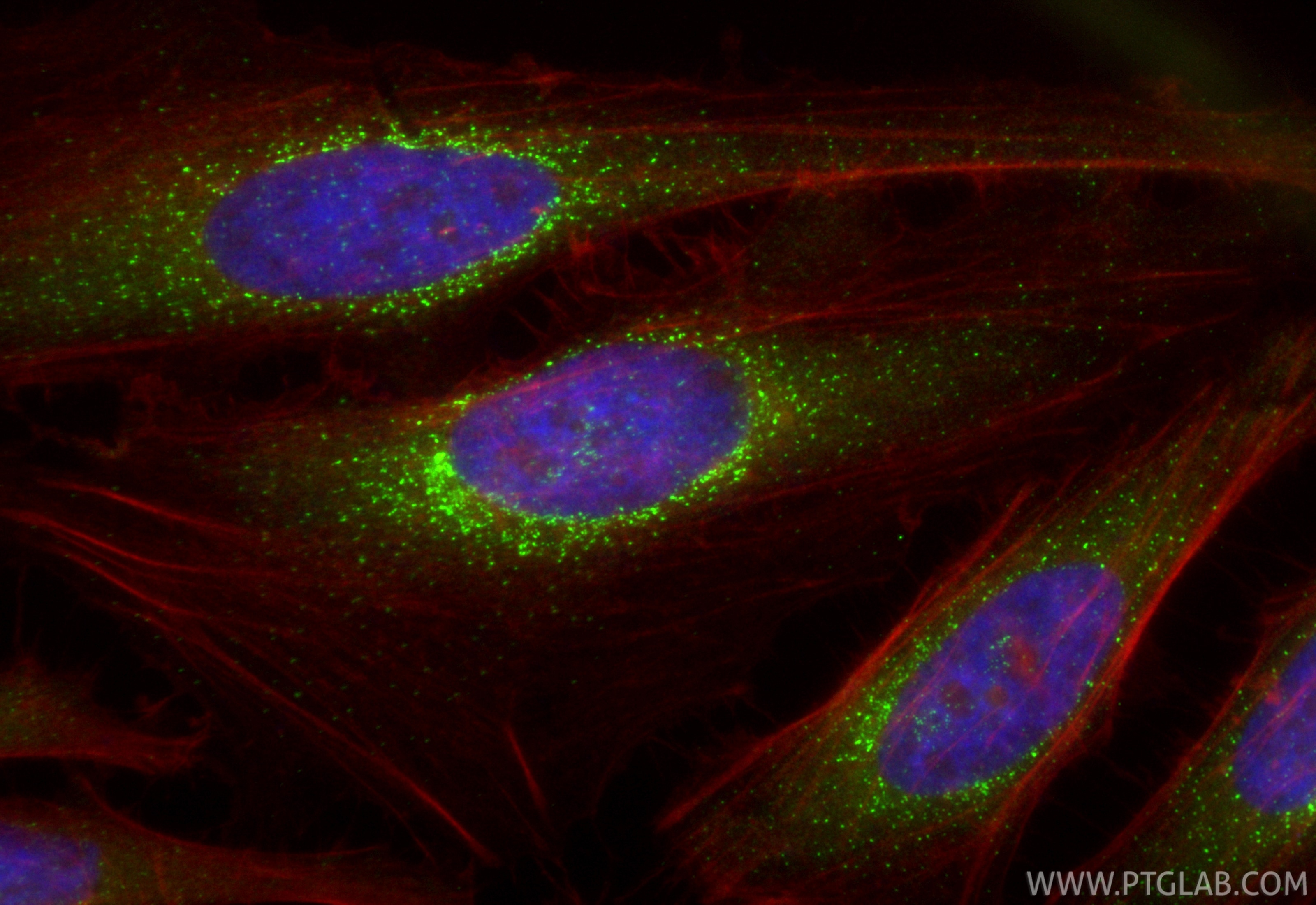 Immunofluorescence (IF) / fluorescent staining of HeLa cells using CoraLite® Plus 488-conjugated SEC31A Recombinant a (CL488-84942-4)