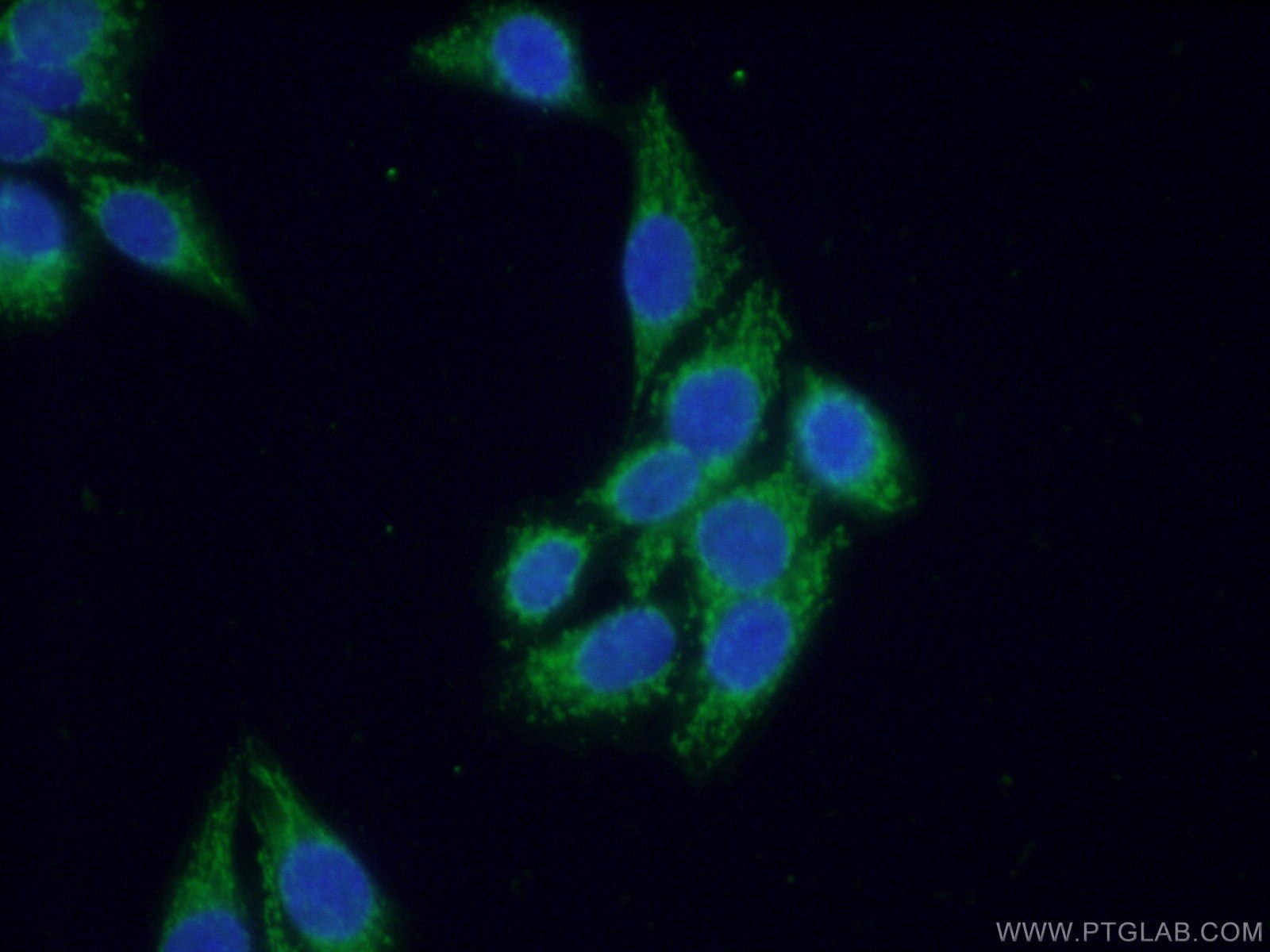 Immunofluorescence (IF) / fluorescent staining of HeLa cells using SEC5/EXOC2 Polyclonal antibody (12751-1-AP)