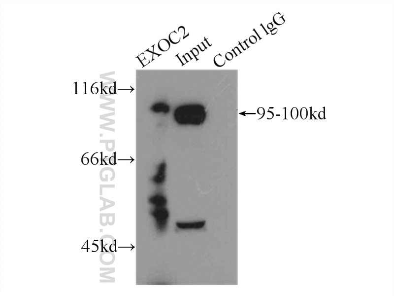 Immunoprecipitation (IP) experiment of mouse brain tissue using SEC5/EXOC2 Polyclonal antibody (12751-1-AP)