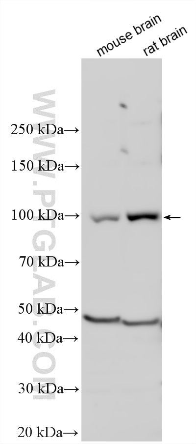 Various lysates were subjected to SDS PAGE followed by western blot with 12751-1-AP (SEC5/EXOC2 antibody) at dilution of 1:3000 incubated at room temperature for 1.5 hours. Western Blot (WB) analysis of various lysates using SEC5/EXOC2 Polyclonal antibody (12751-1-AP)