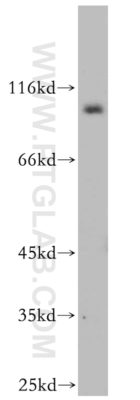 Western Blot (WB) analysis of mouse brain tissue using SEC5/EXOC2 Polyclonal antibody (12751-1-AP)