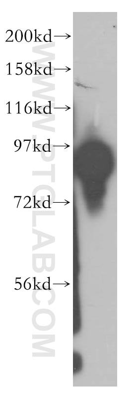 Western Blot (WB) analysis of human brain tissue using SEC5/EXOC2 Polyclonal antibody (12751-1-AP)