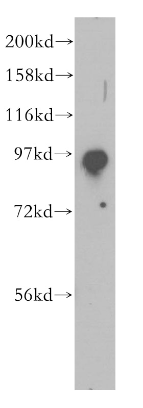 Western Blot (WB) analysis of human ileum tissue using SEC5/EXOC2 Polyclonal antibody (12751-1-AP)