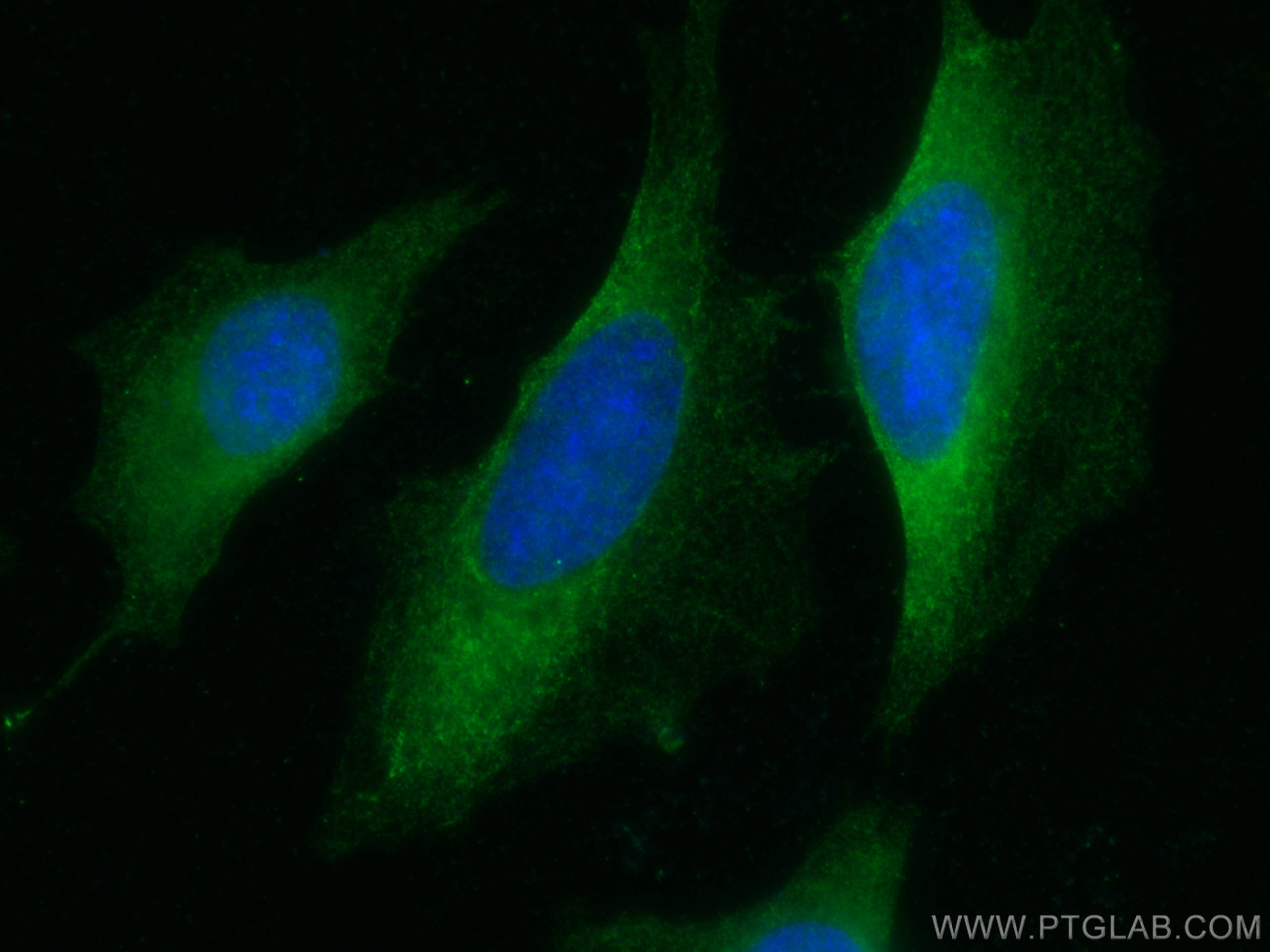 Immunofluorescence (IF) / fluorescent staining of HeLa cells using SEC5/EXOC2 Monoclonal antibody (66011-1-Ig)