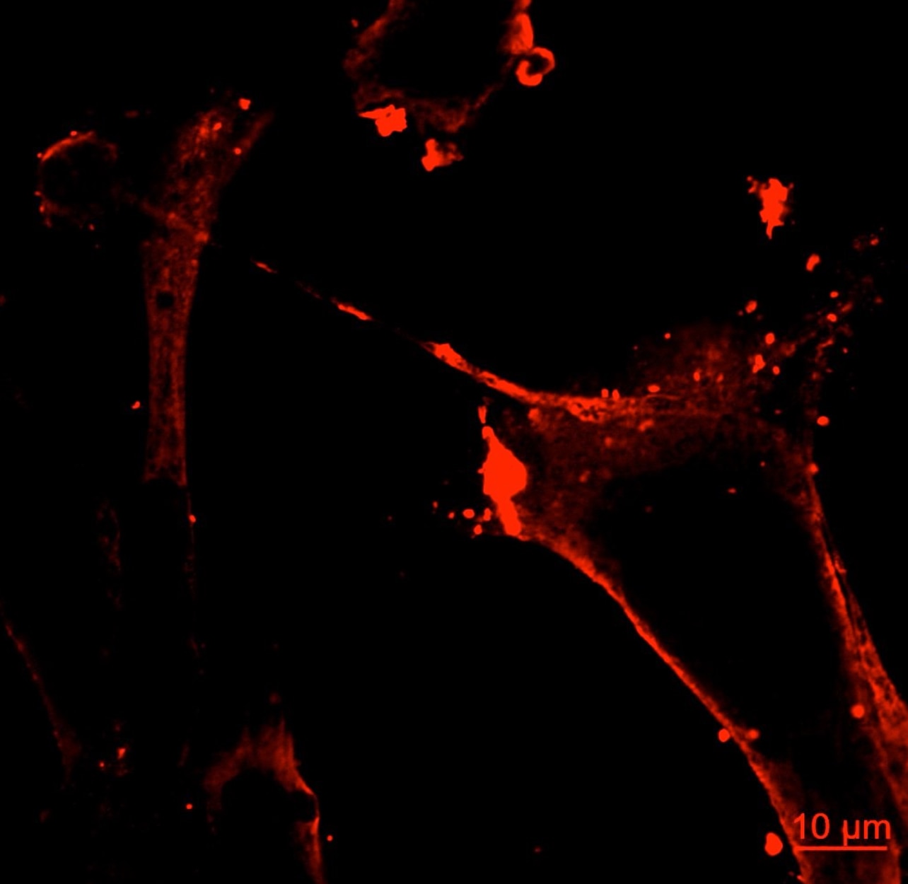Immunofluorescence (IF) / fluorescent staining of MDA-MB-231 cells using SEC5/EXOC2 Monoclonal antibody (66011-1-Ig)