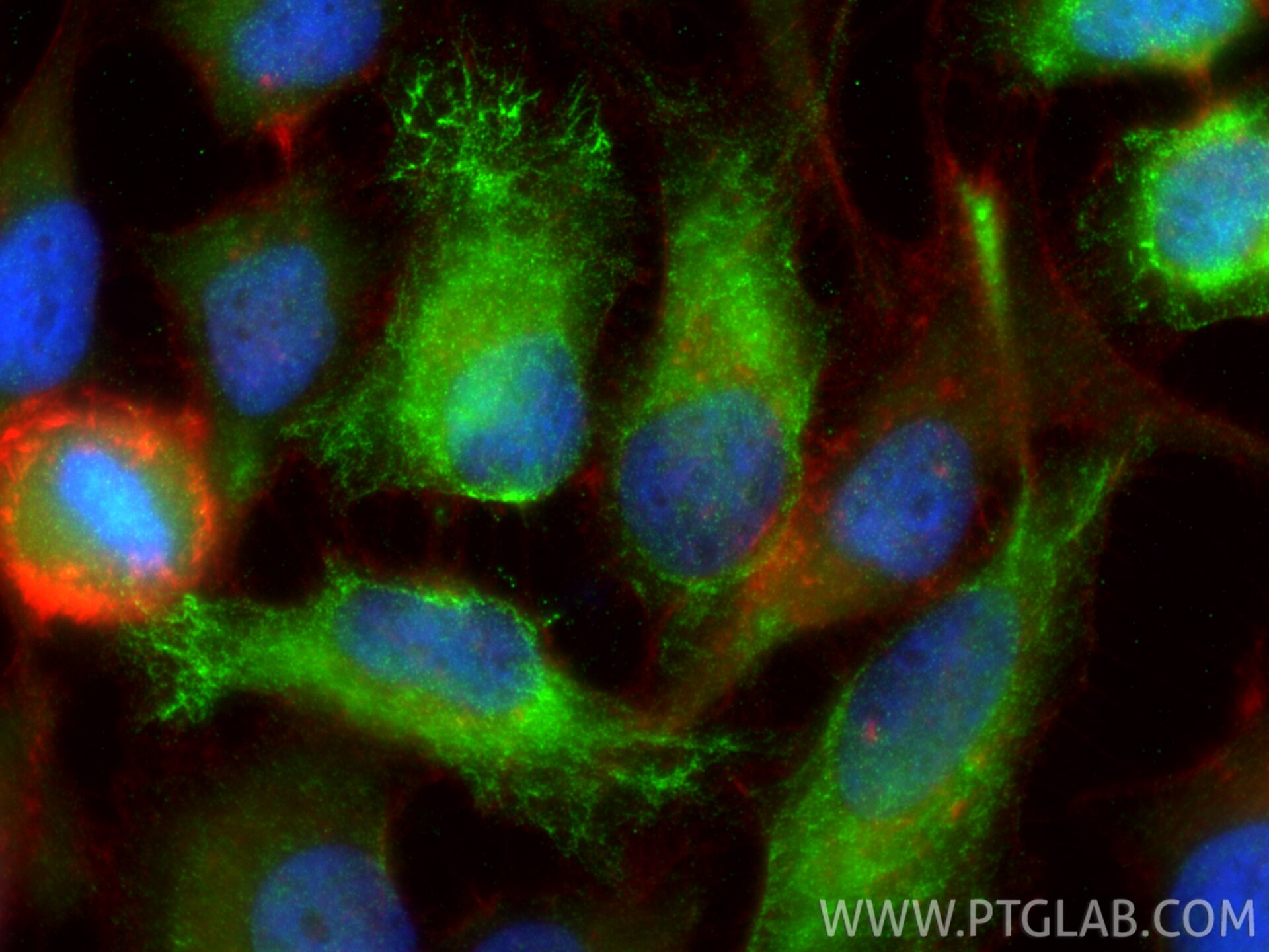 IF Staining of HeLa using 66011-1-Ig Immunofluorescence (IF) / fluorescent staining of HeLa cells using SEC5/EXOC2 Monoclonal antibody (66011-1-Ig)