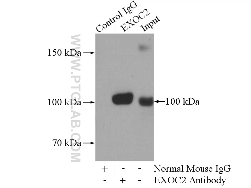 Immunoprecipitation (IP) experiment of mouse brain tissue using SEC5/EXOC2 Monoclonal antibody (66011-1-Ig)