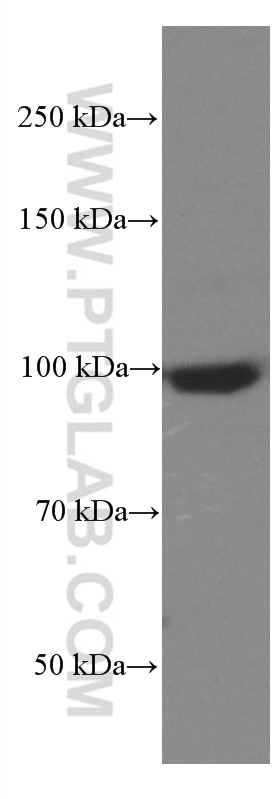 Western Blot (WB) analysis of mouse brain tissue using SEC5/EXOC2 Monoclonal antibody (66011-1-Ig)