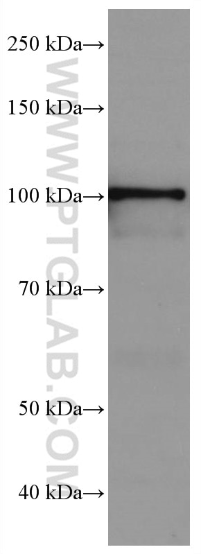 Western Blot (WB) analysis of pig cerebellum tissue using SEC5/EXOC2 Monoclonal antibody (66011-1-Ig)