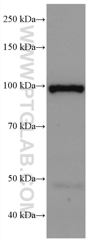 Western Blot (WB) analysis of rat brain tissue using SEC5/EXOC2 Monoclonal antibody (66011-1-Ig)