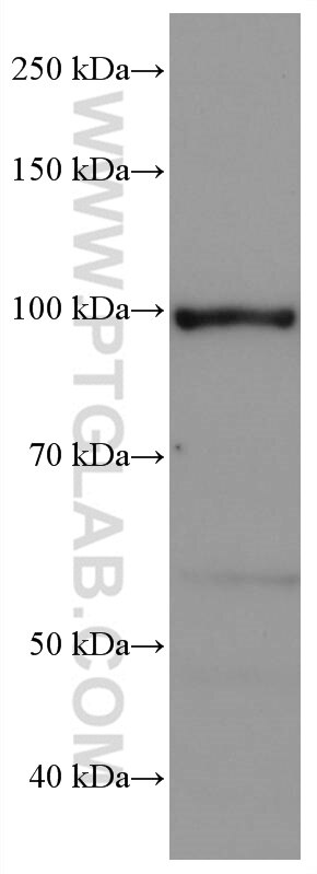 Western Blot (WB) analysis of rat cerebellum tissue using SEC5/EXOC2 Monoclonal antibody (66011-1-Ig)