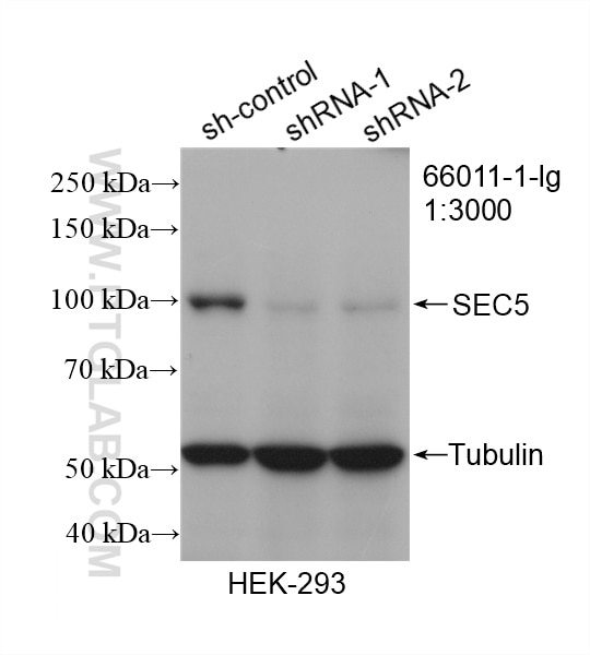 Western Blot (WB) analysis of HEK-293 cells using SEC5/EXOC2 Monoclonal antibody (66011-1-Ig)