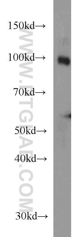 Western Blot (WB) analysis of human brain tissue using SEC5/EXOC2 Monoclonal antibody (66011-1-Ig)