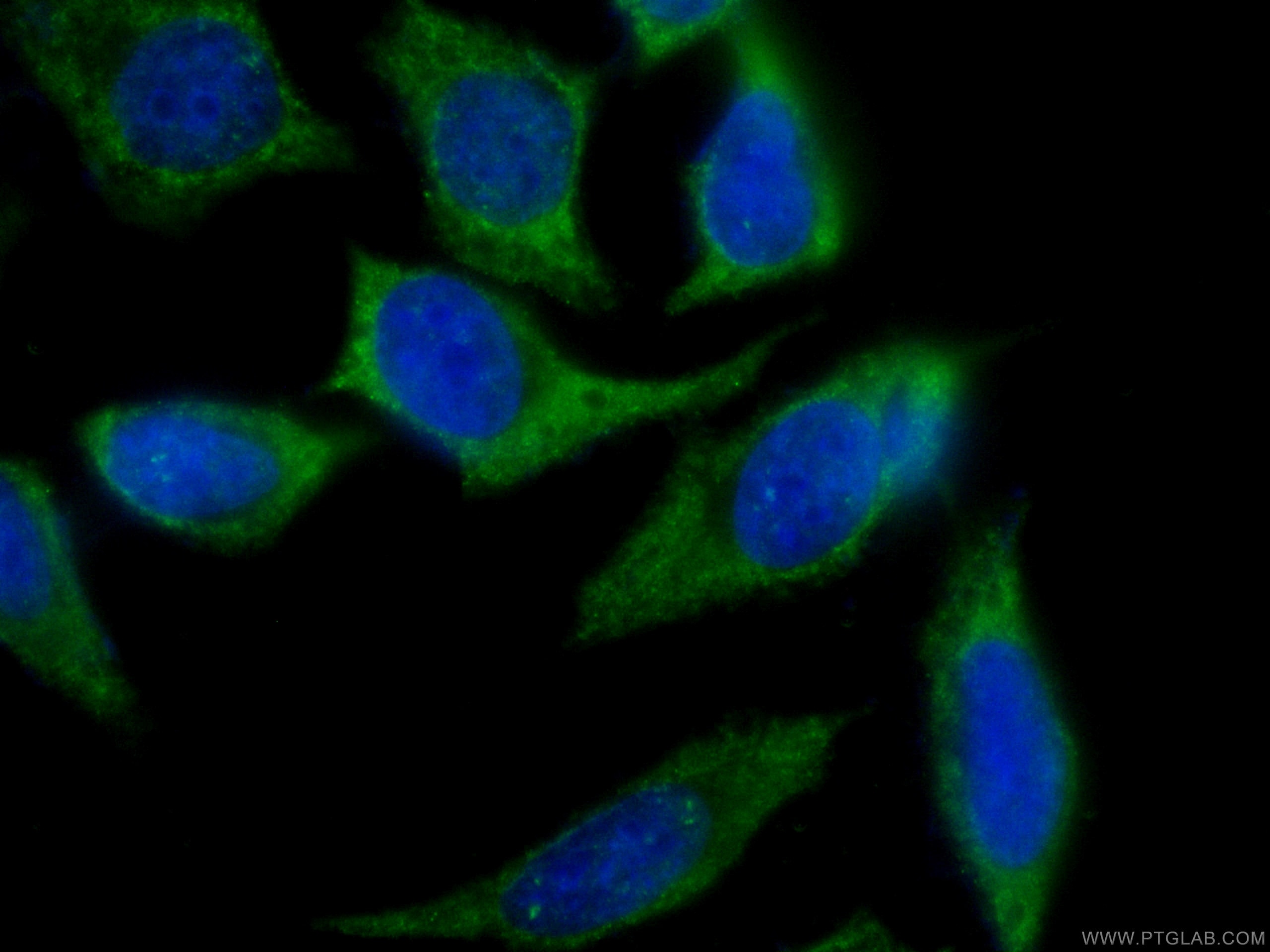 Immunofluorescence (IF) / fluorescent staining of HeLa cells using CoraLite® Plus 488-conjugated SEC5/EXOC2 Monoclona (CL488-66011)