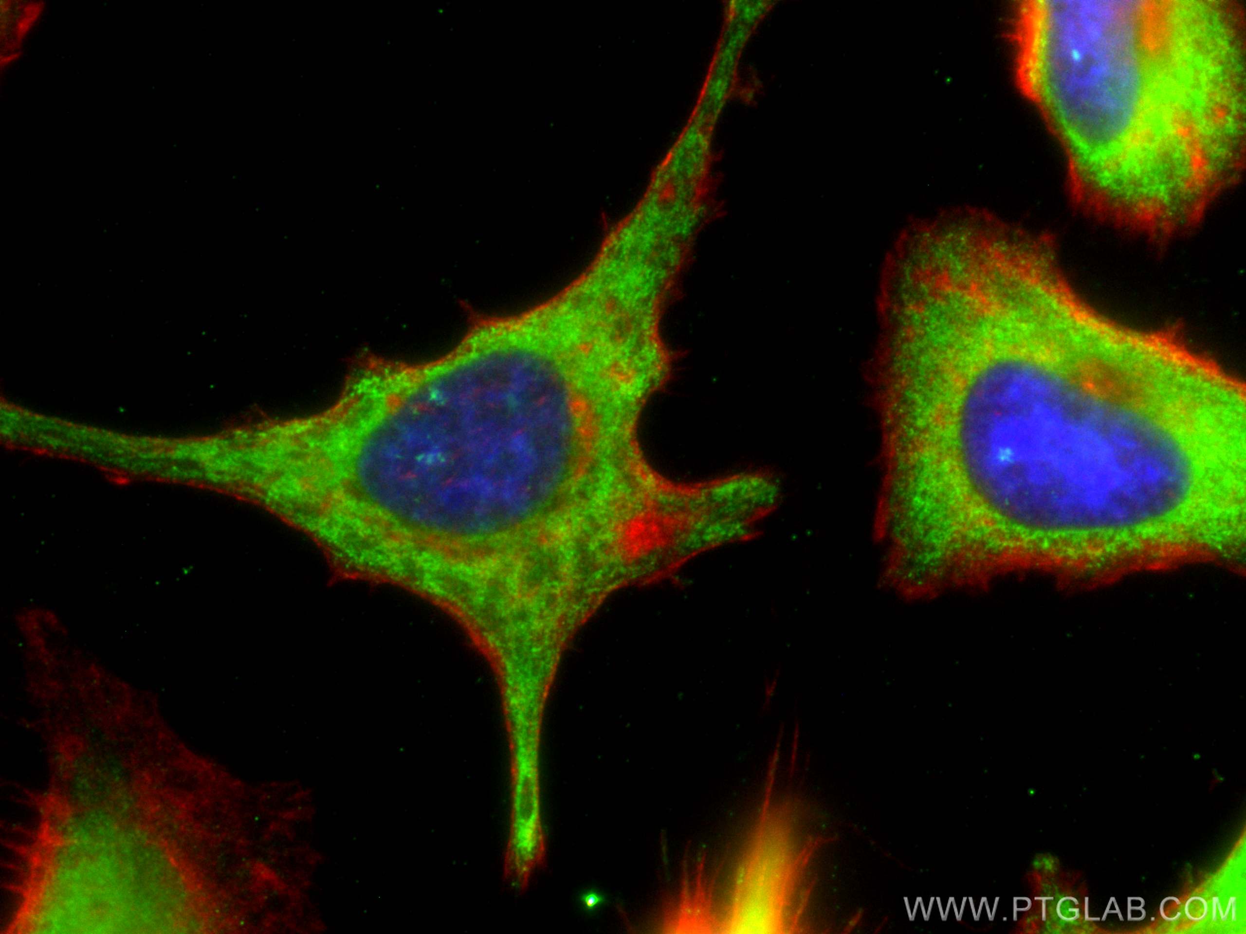 Immunofluorescence (IF) / fluorescent staining of HeLa cells using CoraLite® Plus 488-conjugated SEC5/EXOC2 Monoclona (CL488-66011)