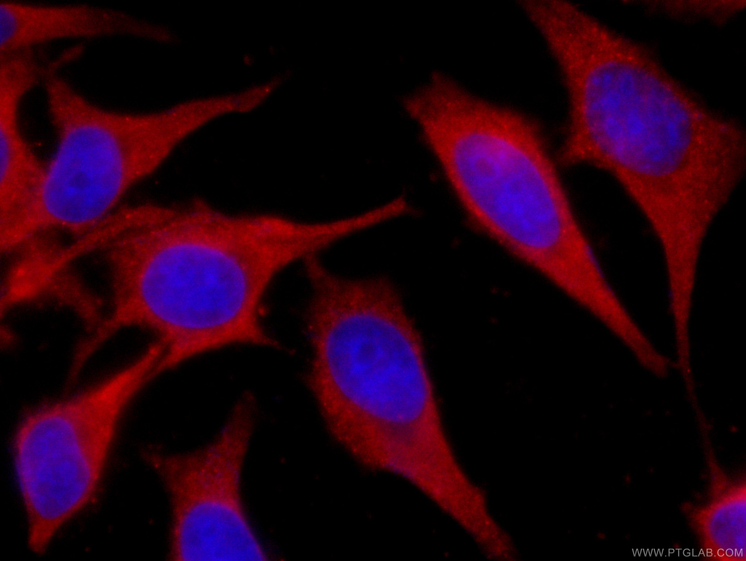 Immunofluorescence (IF) / fluorescent staining of HeLa cells using CoraLite®594-conjugated SEC5/EXOC2 Monoclonal anti (CL594-66011)
