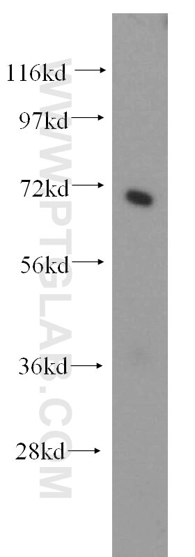 Western Blot (WB) analysis of mouse liver tissue using SEC61 Alpha Polyclonal antibody (15512-1-AP)