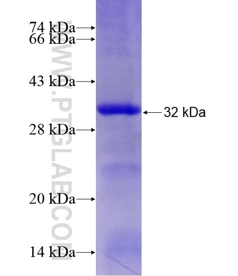 SEC61A2 fusion protein Ag28466 SDS-PAGE SEC61A2 fusion protein Ag28466 SDS-PAGE
