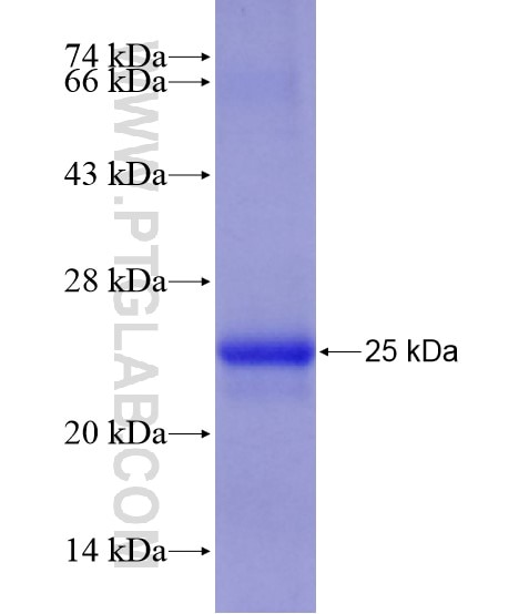 SEC61A2 fusion protein Ag20779 SDS-PAGE