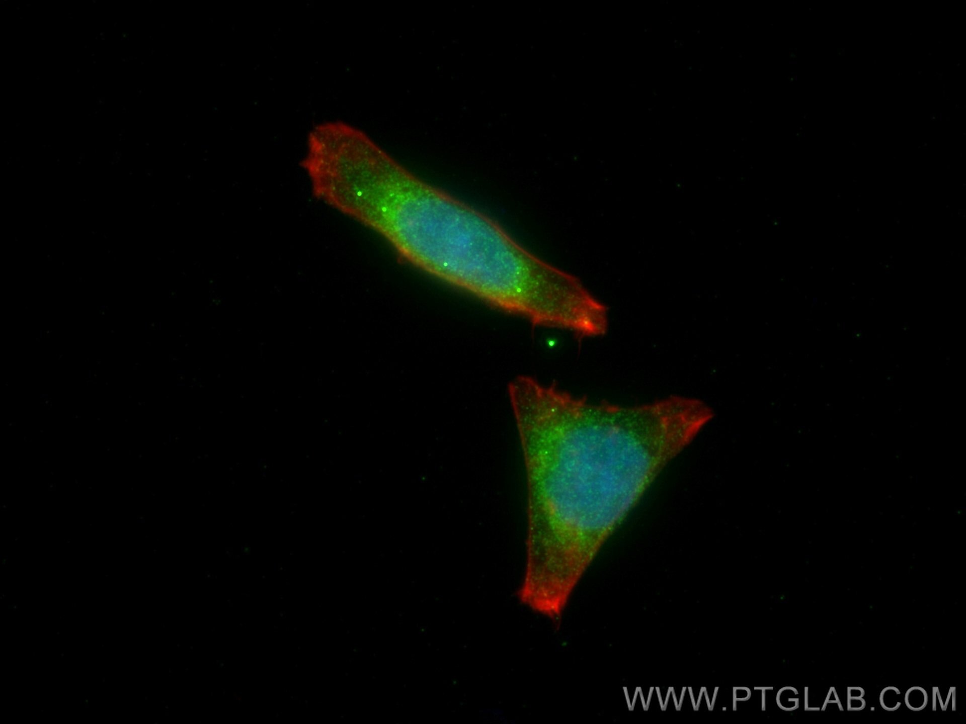 Immunofluorescence (IF) / fluorescent staining of HepG2 cells using SEC61B Polyclonal antibody (15087-1-AP)