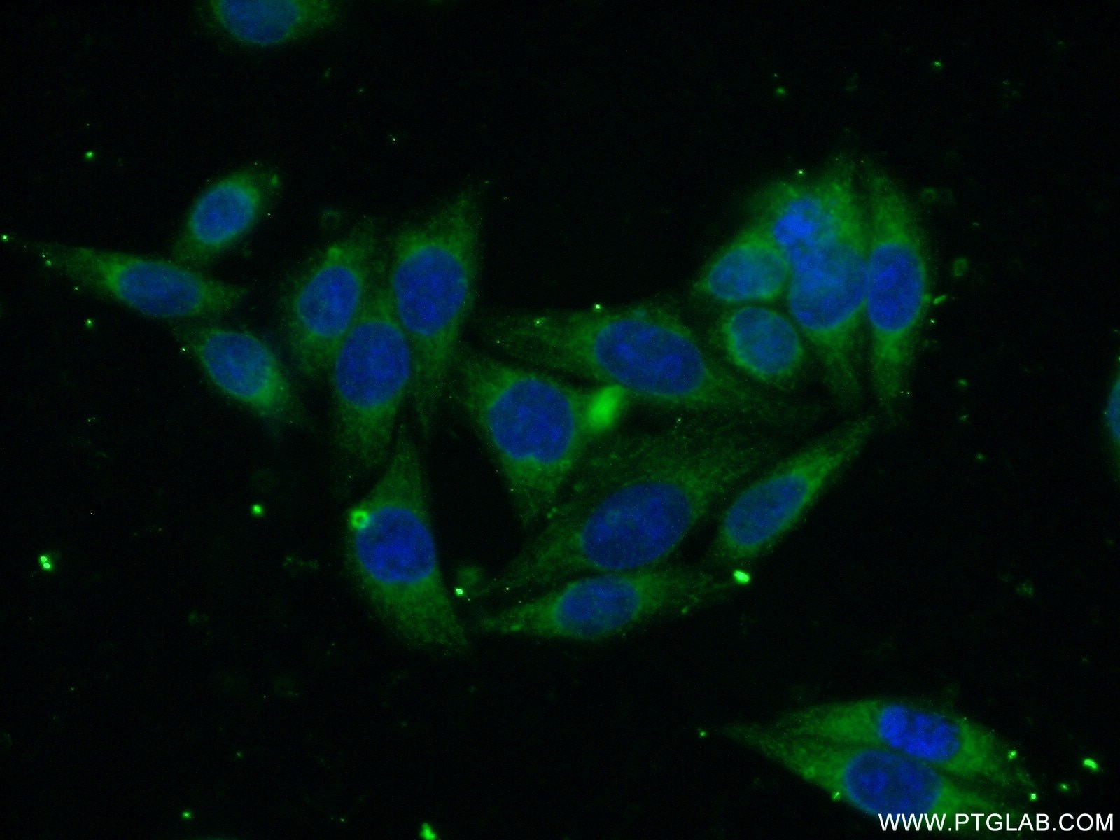 Immunofluorescence (IF) / fluorescent staining of HeLa cells using SEC61B Polyclonal antibody (15087-1-AP)