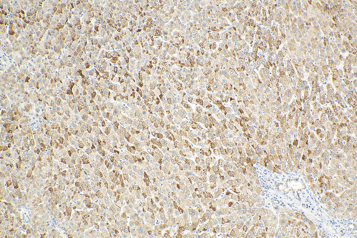 Immunohistochemistry (IHC) staining of human liver tissue using SEC61B Polyclonal antibody (15087-1-AP)