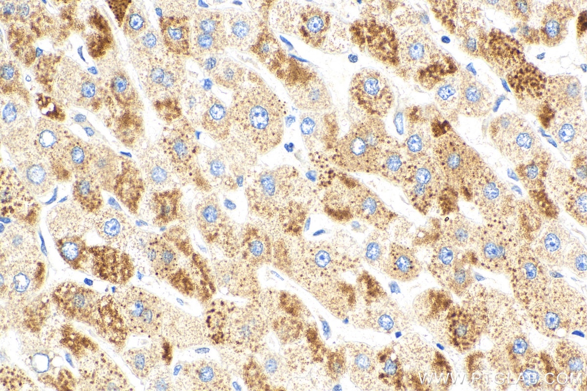 Immunohistochemistry (IHC) staining of human liver tissue using SEC61B Polyclonal antibody (15087-1-AP)